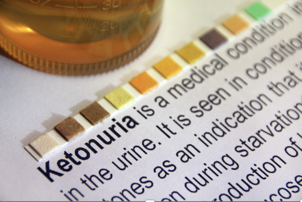 Understanding Ketosis, Ketonuria, and Ketoacidosis: What Pregnant Women Need to Know
